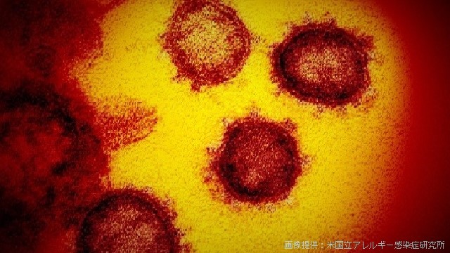 感染者の多い国や地域 新型コロナウイルス（２日午前４時）