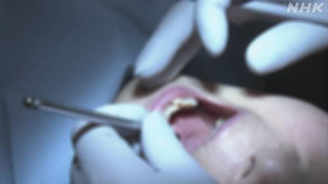 コロナ感染不安「歯科受診控えると肺炎などリスク高」歯科医師