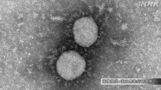 ヒトコロナウイルスOC43