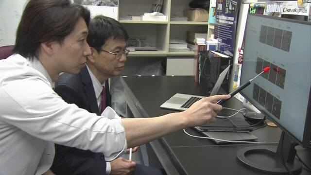 コロナ “脳で免疫の働きする神経系の細胞に感染” 慶応大など | NHK