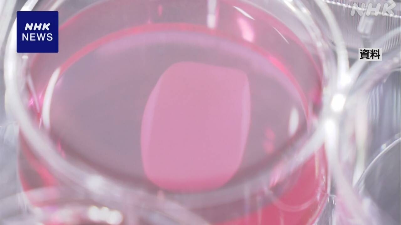 iPS細胞で新たな治験へ 重い心臓病の患者に細胞シート移植 | NHK