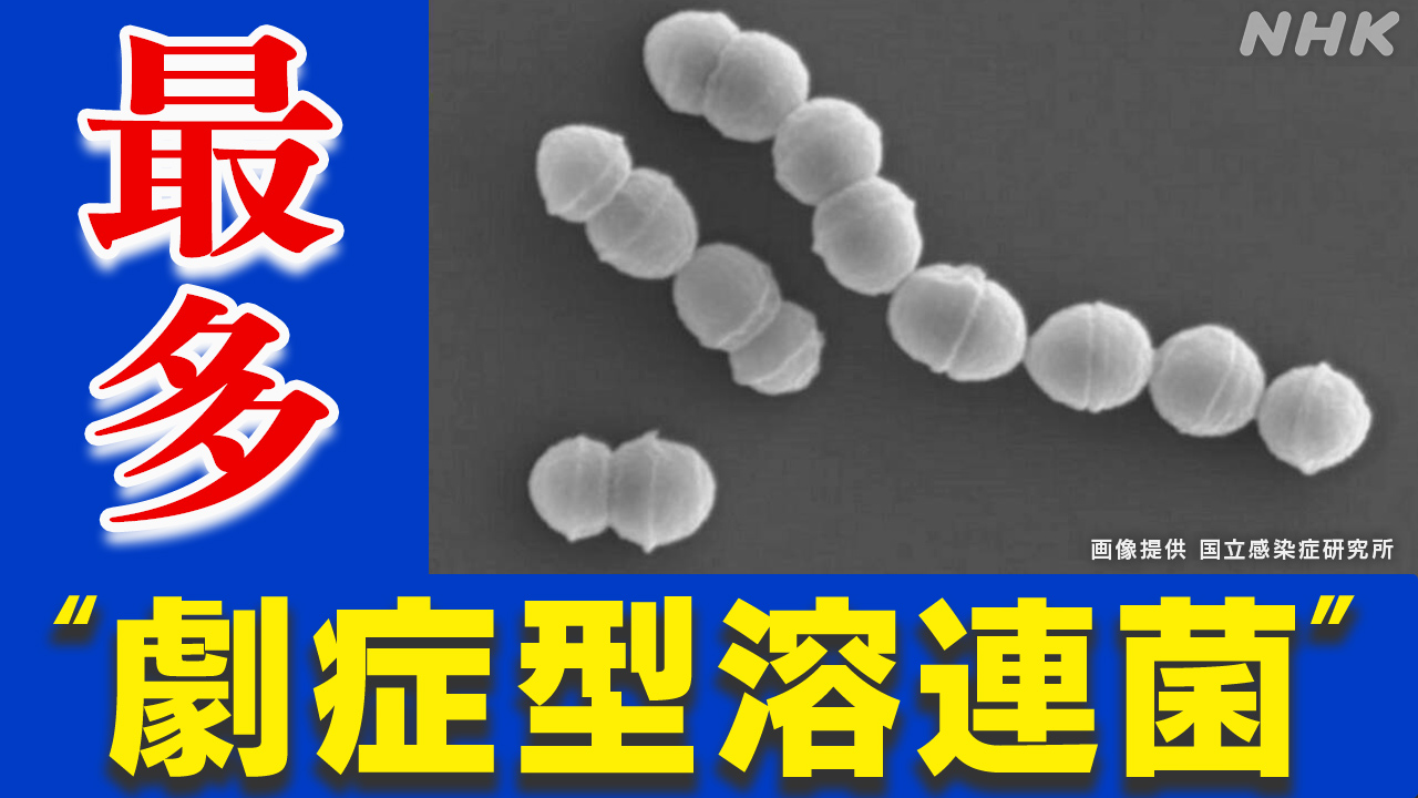 「劇症型溶血性レンサ球菌感染症」ことしの患者数 過去最多に | NHK