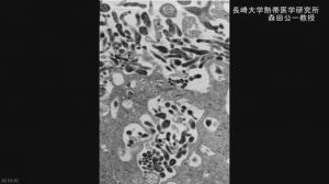 致死率高い「ニパウイルス感染症」東大医科研がワクチン開発