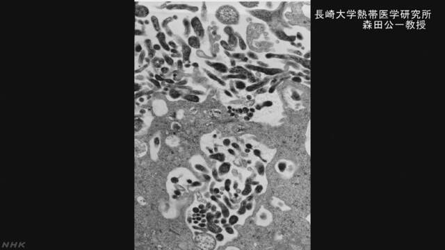 致死率高い「ニパウイルス感染症」東大医科研がワクチン開発