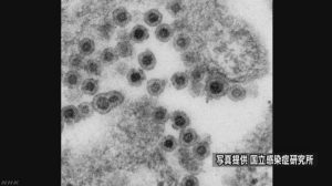 「先天性風疹症候群」の子どもを都内で確認