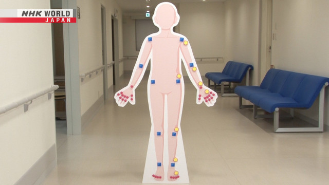 17 Rheumatoid Arthritis Gadgets Images, Stock Photos, 3D objects